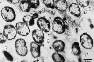 Figure 2.  Bacterial population of the rumen fluid of a cow with pasture bloat - the arrows indicate slime