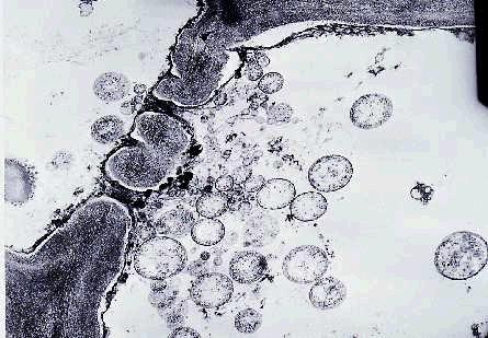 Figure 7. Electron micrograph of phytoplasma bodies (circular to