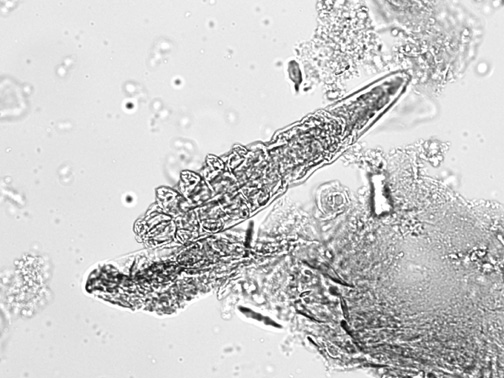 Figure 1. Demodex mite released from a hair follicle.