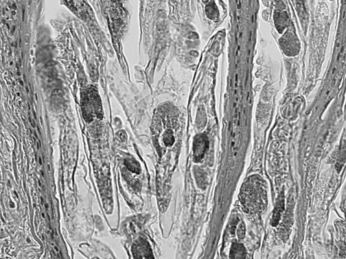 Figure 2B. Demodex mites in a hair follicle (enlarged view of Figure 2A).
