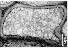 Figure 9. Transmission electron micrograph of a ultrathin section