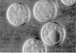 Figure 12. Entomophaga fungus resting spores. Twenty-five laid end to end would measure 1 mm. 