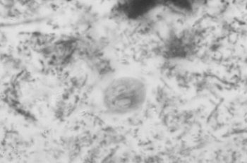 Figure 1. Giardia spp. as seen in a fecal smear.