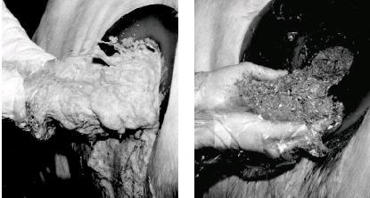 Figure 5.  Left: foaming rumen contents from cows fed fine-particle feed creates a potential for bloat.